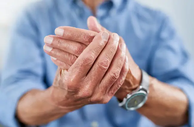 Arthritis Physiotherapy, arthritis treatment